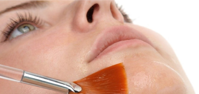 Peeling