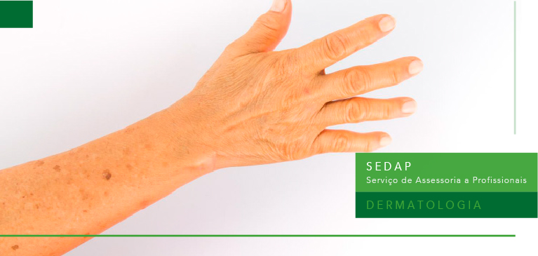 Associação Entre Agrião e Genisteína no Clareamento das Manchas Senis nas Mãos