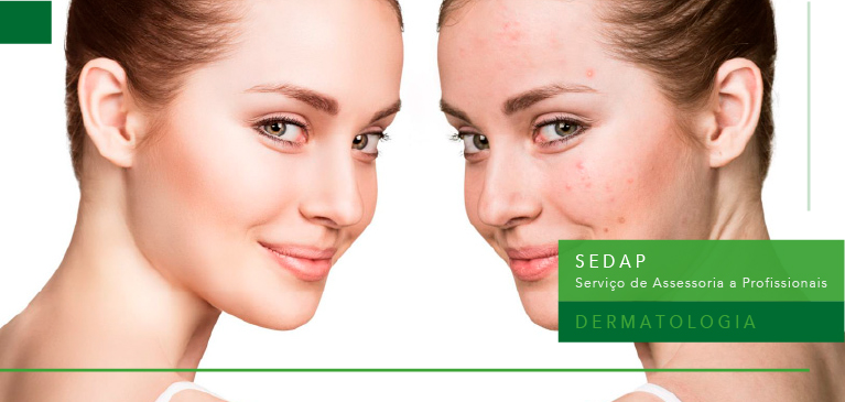 Doxiciclina em Pacientes com Acne