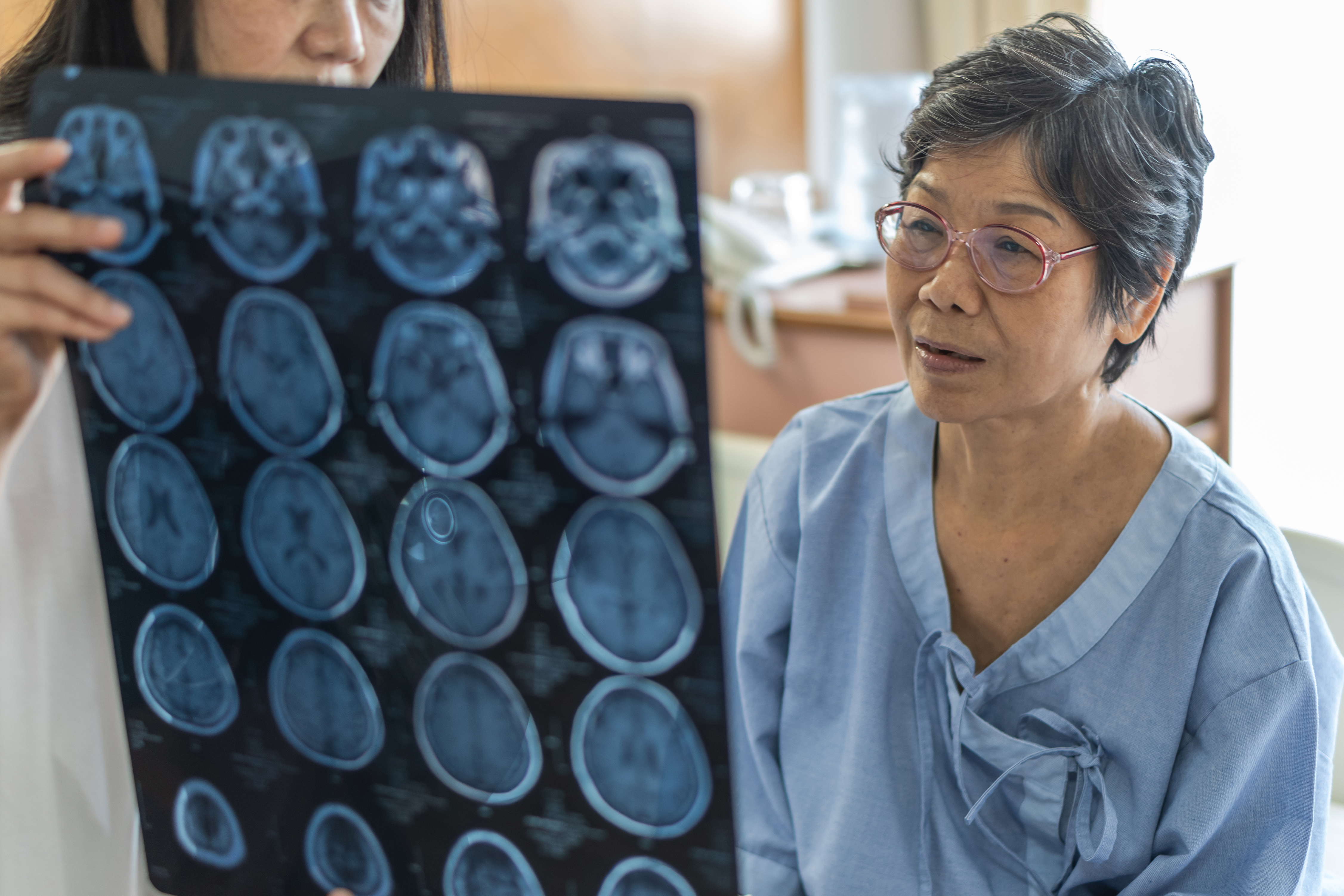quando perceber algumas falhas na memória, procure orientação médica para o melhor tratamento e conhecimento.