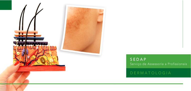 Novo Ativo com Ação Despigmentante Derivado da Diacetil Boldina