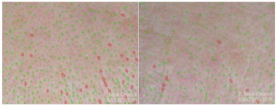 Benefícios dos Suplementos Compostos de Colágeno Benefícios dos Suplementos Compostos de Colágeno