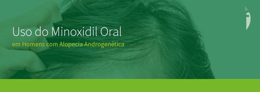 Estudo Demonstra o Uso do Minoxidil Oral em Homens com Alopecia Androgenética