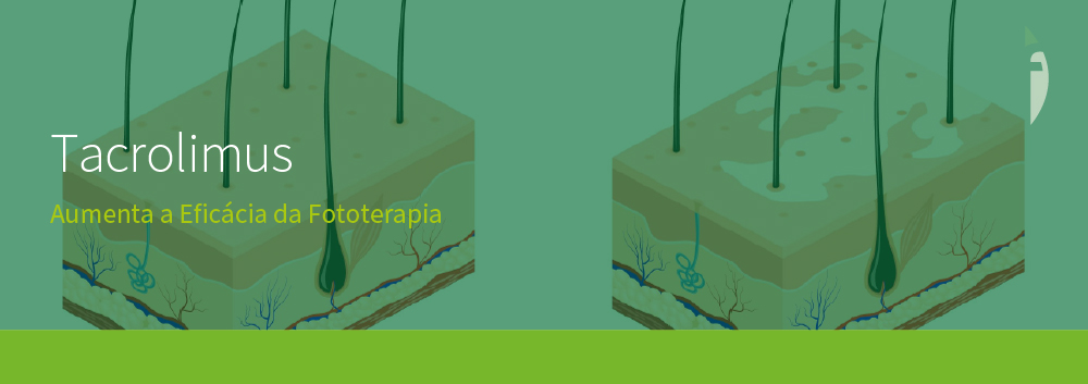 Tacrolimus Aumenta a Eficácia da Fototerapia